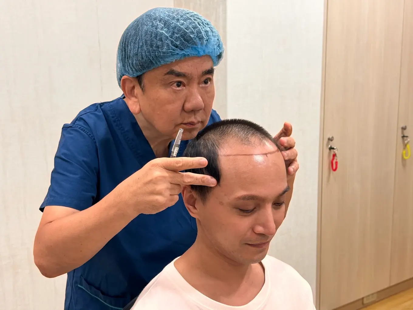 評估植髮範圍與數量