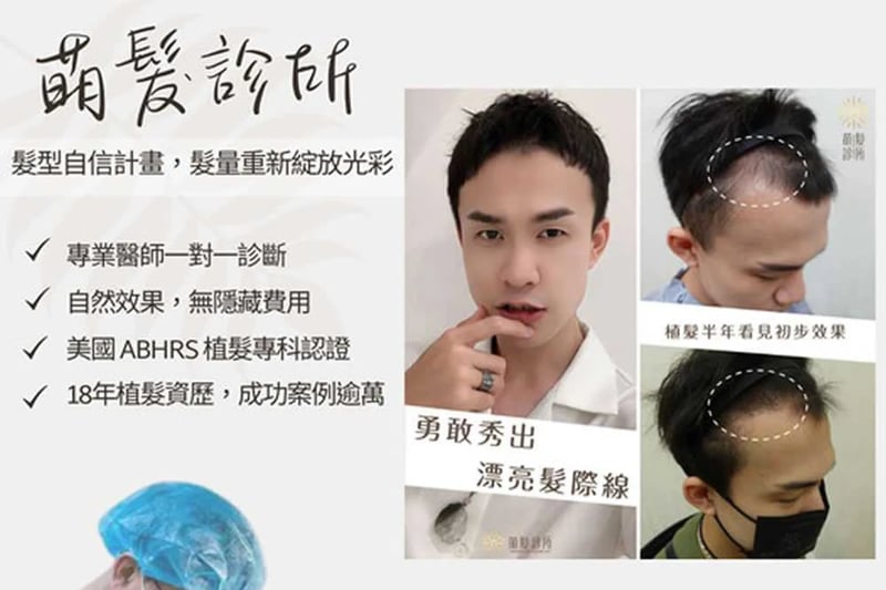 植髮效果可以達到期望嗎？密度、髮線同手術限制