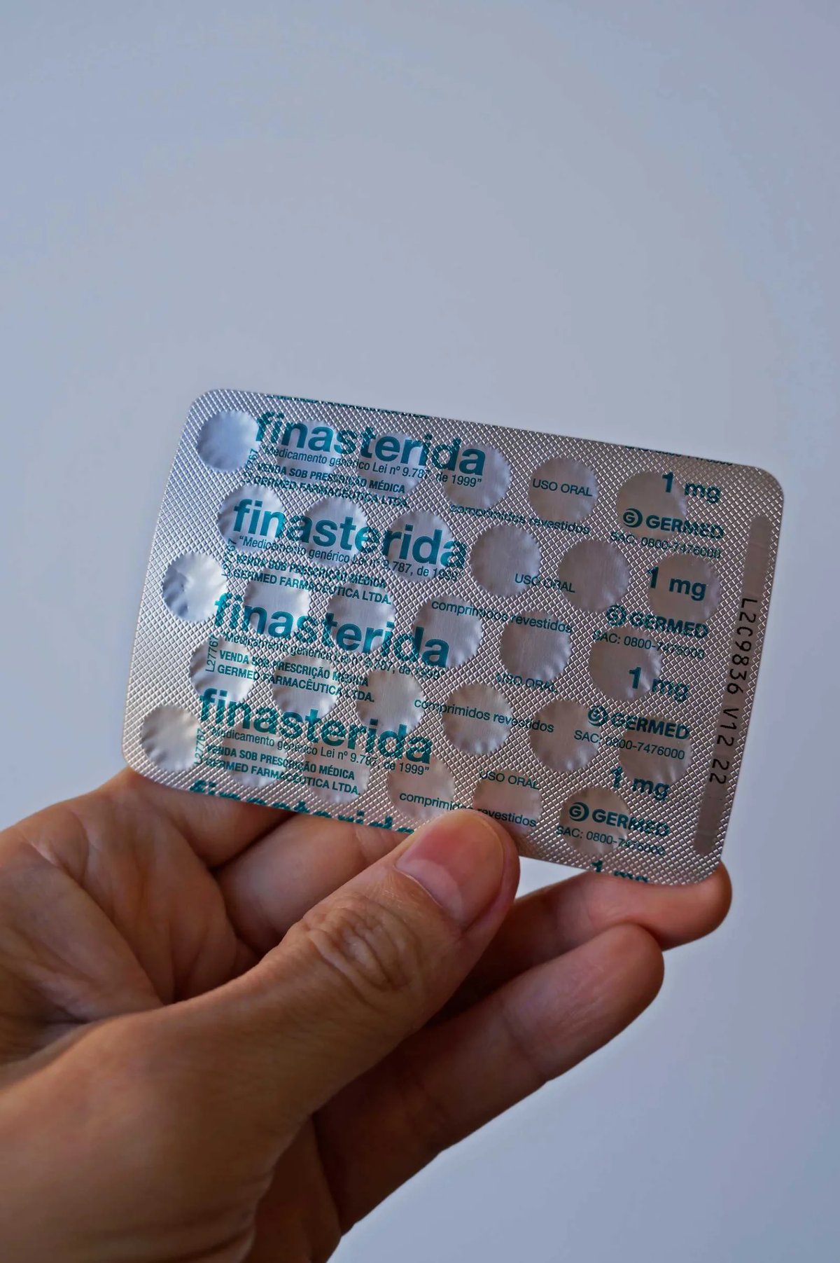 Finasteride suppresses DHT to protect native hair; it is a prescription drug — use and dose must be assessed by a doctor