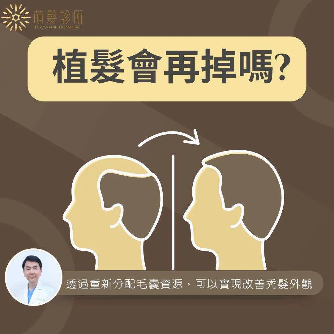 What sheds early after surgery is usually the shaft; the follicle may remain under the skin, so track regrowth against the timeline